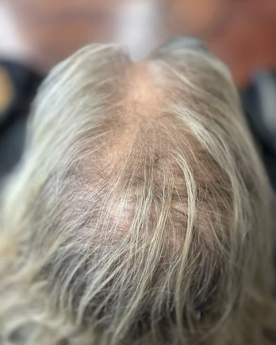 Hair before using a filtered shower head