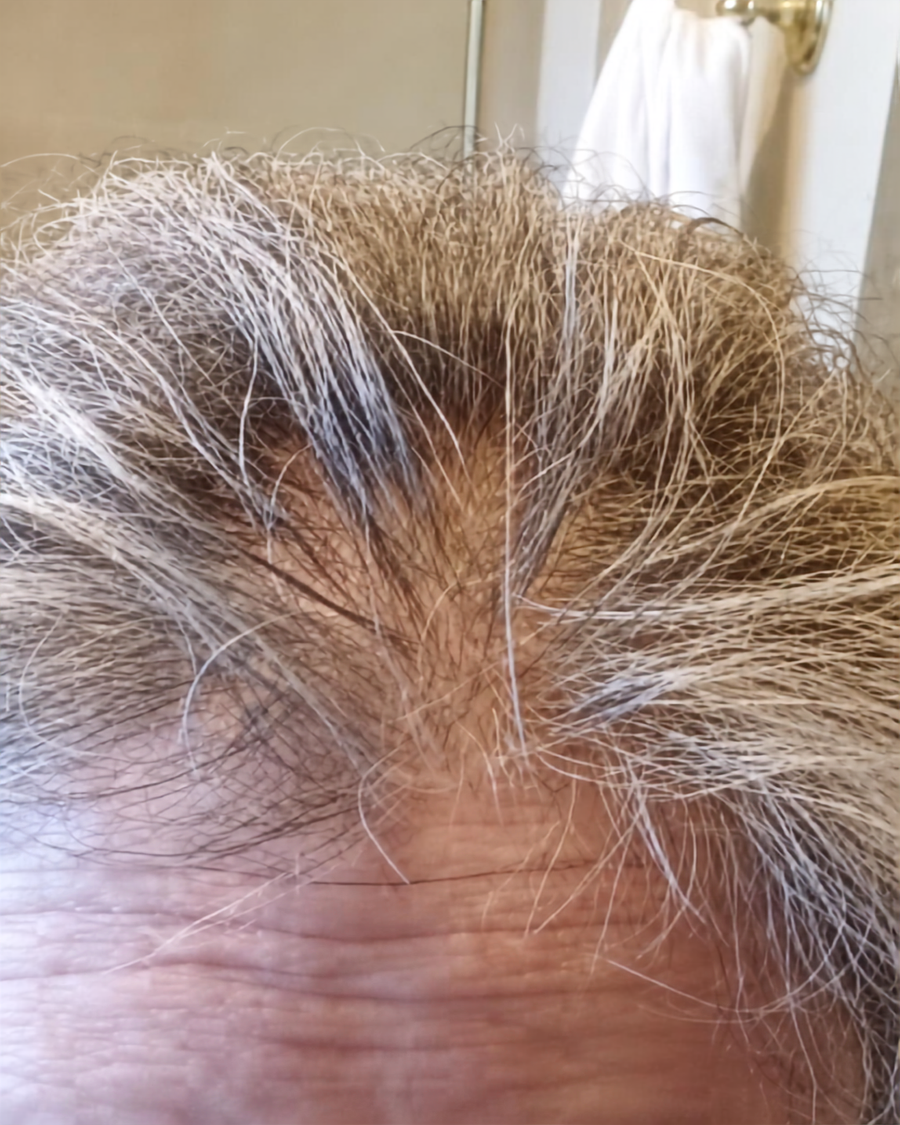 Hair before using a filtered shower head