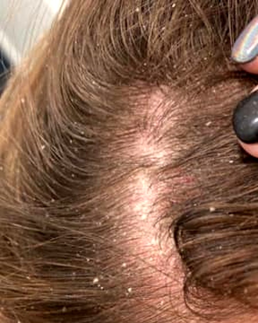 Hair before using a filtered shower head
