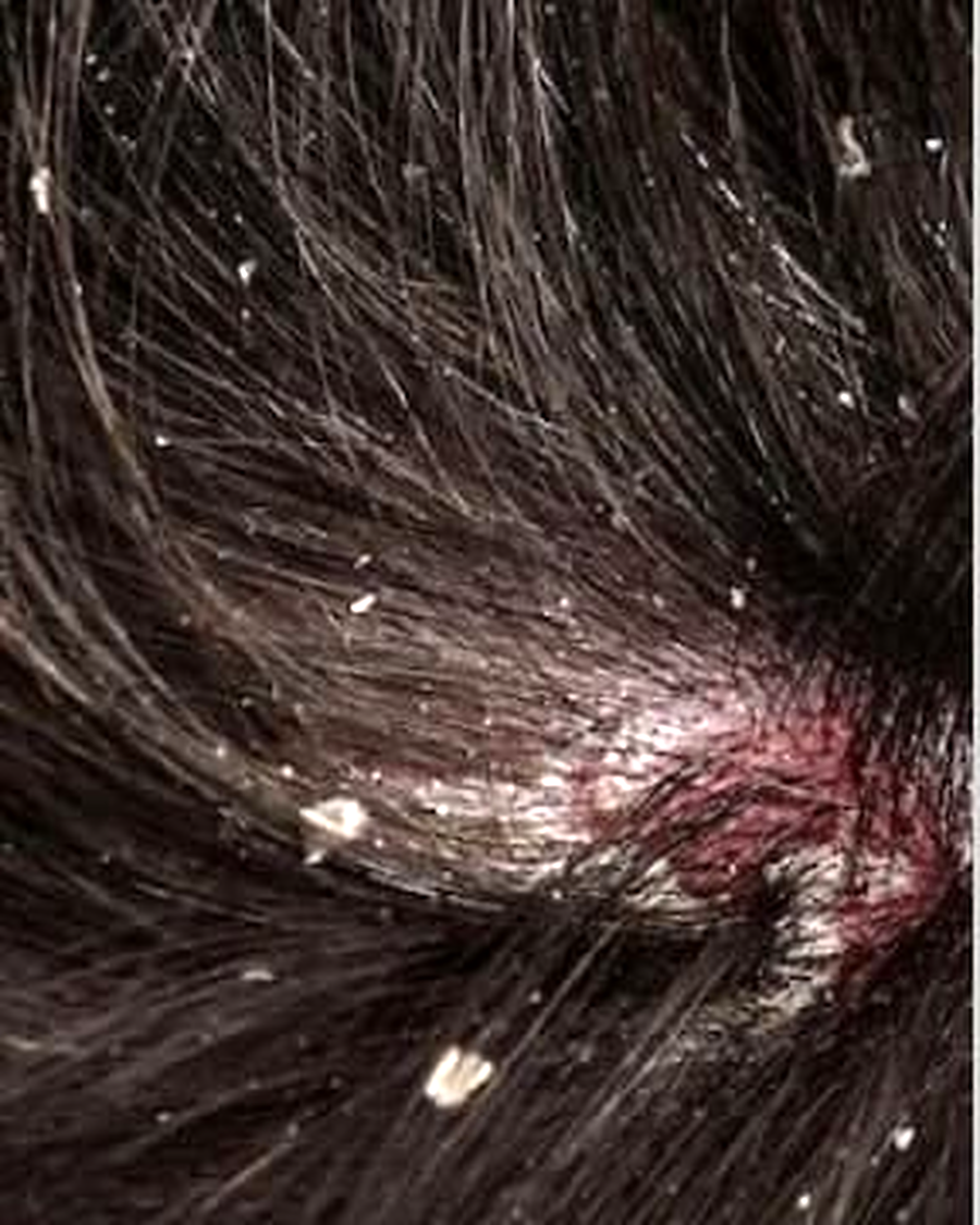 Hair before using a filtered shower head